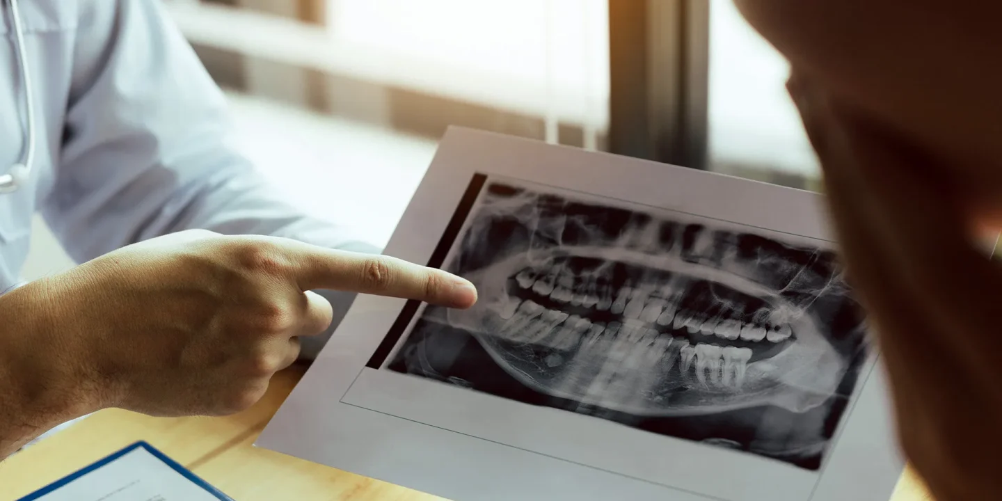 dental-doctor-showing-x-ray-to-patient-2026-03-17-21-41-31-utc copia